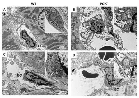 Oxidative Stress and Mitochondrial Abnormalities Contribute to ...