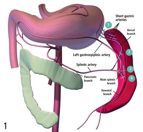 Splenic Artery Cat