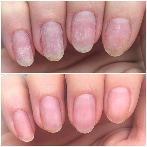 IBX Nail Treatment : Kings Beauty