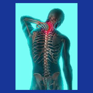 Neck Muscle Spasm - Neck Pain