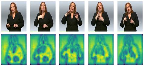 OVSLT: Advancing Sign Language Translation with Open Vocabulary