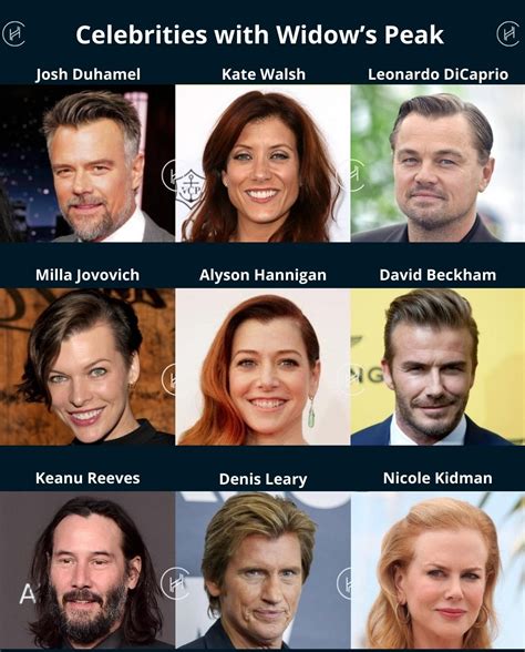 Widow's Peak Hair Transplant - Procedure and Costs in 2024