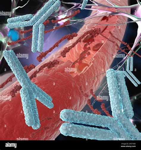 Illustration of antibodies (blue) targeting fibrinogen (dark red) that is leaking from a damaged ...