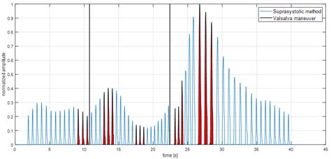 Feasibility of Brachial Occlusion Technique for Beat-to-Beat Pulse Wave ...