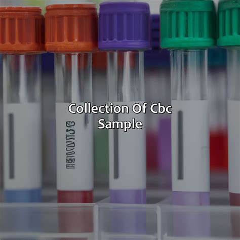 What Color Tubes Are Used For Cbc And Cmp at Wallace Yang blog