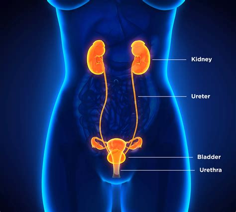 Kidney stones and treatment methods — Dornier MedTech Americas
