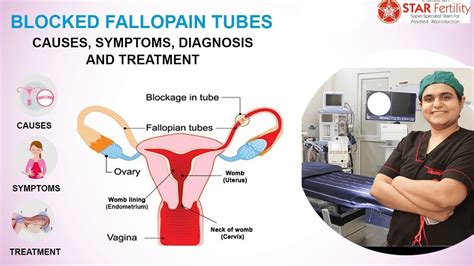 Image result for Fallopian Tube Blockage Surgery