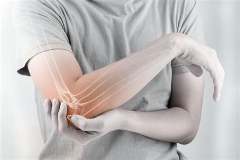 【手踭痛】6個手肘關節痛原因+網球肘如何治療| Perfect Health