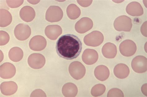 Image result for Lymphocytes Microscopic View