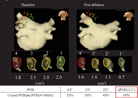 Figure 1 from The Incidence and Factors Associated With the Occurrence ...