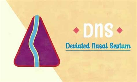 Deviated nasal septum (DNS)- Standard Treatment Guideline By Government ...