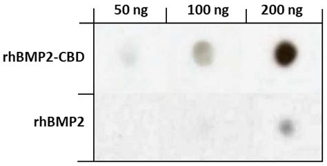 Collagen Type I Biomaterials as Scaffolds for Bone Tissue Engineering