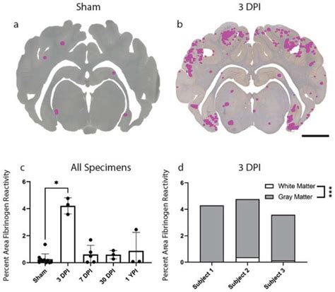 Persistence of Hyper-Ramified Microglia in Porcine Cortical Gray Matter ...