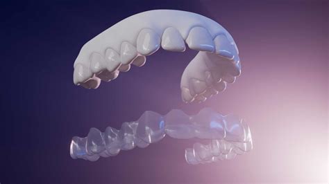 Invisalign Animation 的图像结果