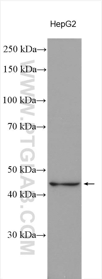 APOA5 antibody (18019-1-AP) | Proteintech
