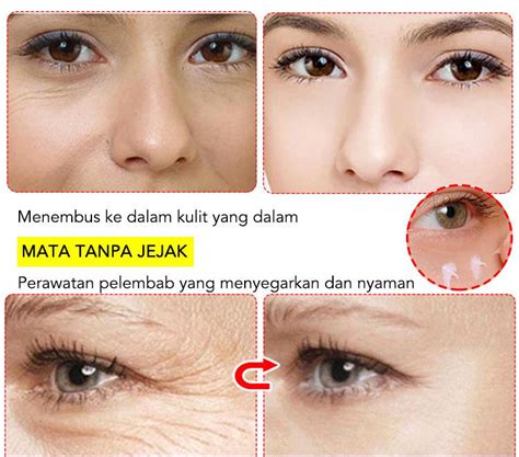 Astaxanthin Caviar Krim Mata-Kantung Mata/Lingkaran Hitam/Anti-penuaan ...