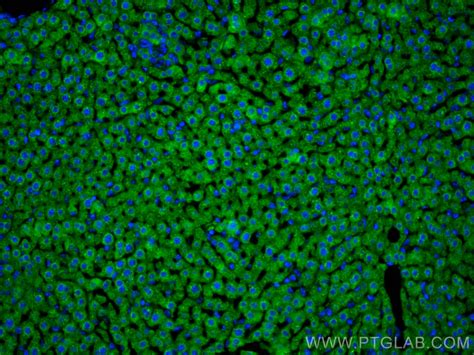 APOB antibody (20578-1-AP) | Proteintech