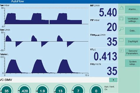 APRV (Modes de Ventilation) - un regard plus approfondi sur l'APRV ...
