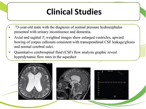 CSF Flow MRI 的图像结果