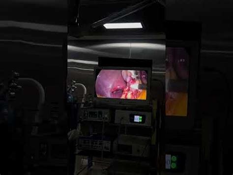 Endoscopy Camera - Telepack Endoscopy System from Ghaziabad