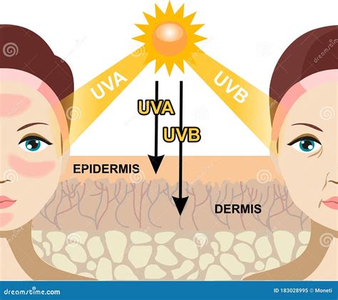 Infographic Illustration Of Difference Between UVA And UVB Rays. UV Penetration Into Human Skin ...