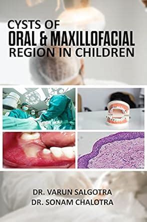 Buy Cysts of oral and Maxillofacial region in children Book Online at ...