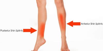 Physiocure | The sports Rehab clinic.