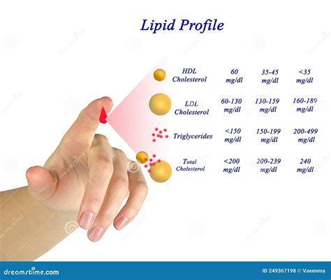 Lipid Profile Result Royalty-Free Stock Image | CartoonDealer.com #64235968