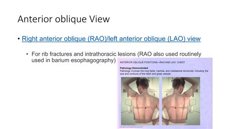 Chest radiography positioning and Technique.pptx