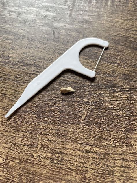 Image result for Bottom Teeth Calcium Buildup