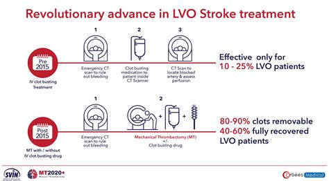 White Paper - Mission Thrombectomy