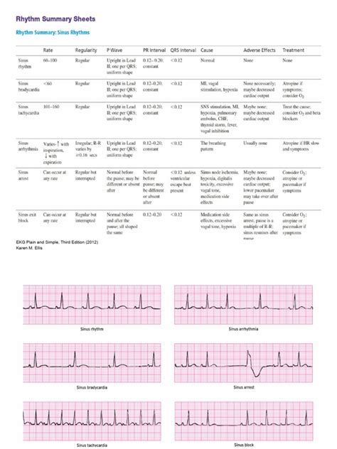 Basic EKG Class 的图像结果