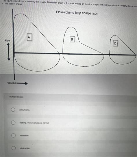 Image result for Spirometry Test Normal Values