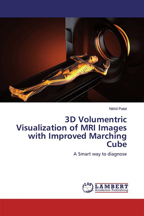 Buy 3D Volumentric Visualization of MRI Images with Improved Marching ...