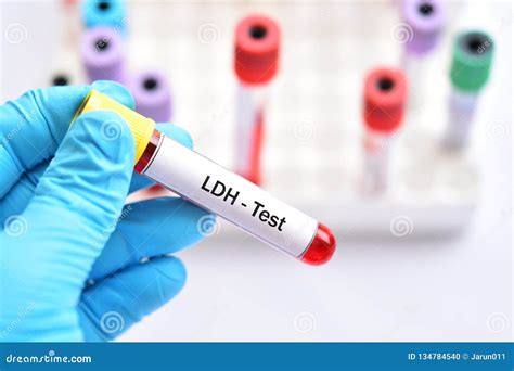 Lactate Dehydrogenase Test