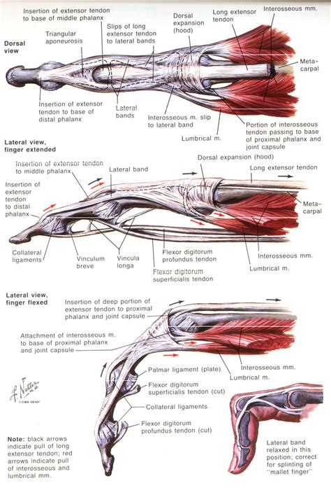 Radshare: BOUTENNIERE DEFORMITY