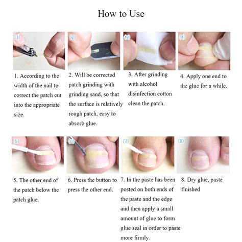 Curled Toenails Fix 的图像结果