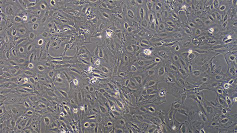 Primary Rat Renal Tubular Epithelial Cells (RTEC)