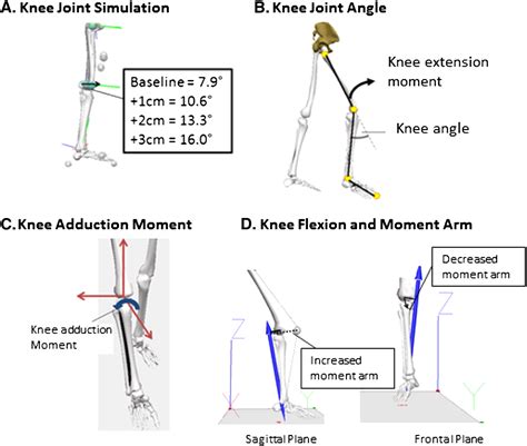Modelling knee flexion effects on joint power absorption and adduction ...