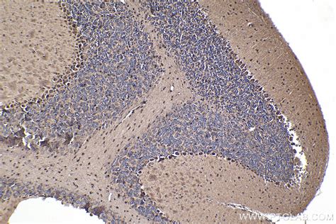 GBP3 antibody (30719-1-AP) | Proteintech