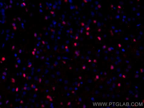 SOX2 antibody (CL594-66411) | Proteintech