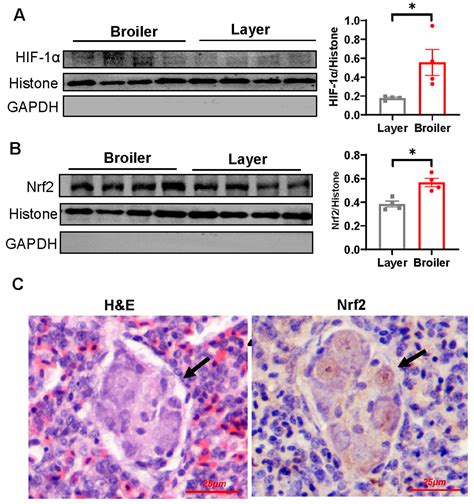 Dysregulated VEGF/VEGFR-2 Signaling and Plexogenic Lesions in the ...