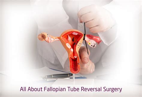 Image result for Fallopian Tube Surgery