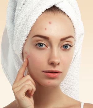 Black Marks Treatment in Hyderabad, Dark Spot Removal in Hyderabad ...