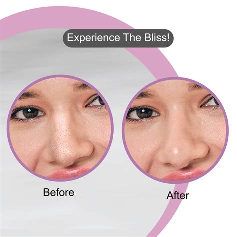 Charcoal Nose Strips for Blackheads (with Wet Wipes) – Dr.Rashel