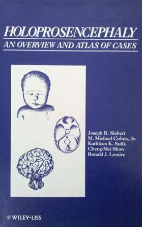 Buy Holoprosencephaly: An Overview and Atlas of Cases Book Online at ...