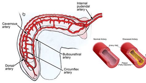 Image result for Ed Blood Flow Problems