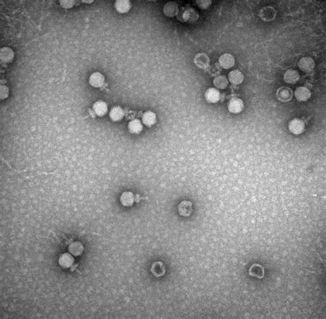 How do bacteria defend themselves against viruses? | eLife Science Digests | eLife
