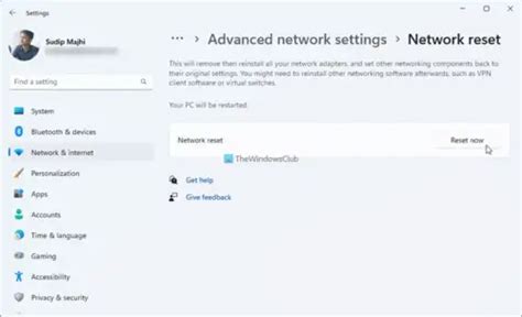 Image result for Fix Local Area Connection IP Configuration