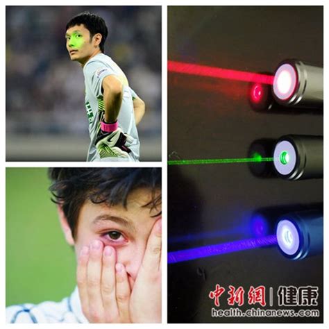 激光笔照射眼睛几秒险致失明，这种颜色的激光笔一定不能玩！